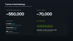 Trained on ~550K QA samples and ~70K CT volumes