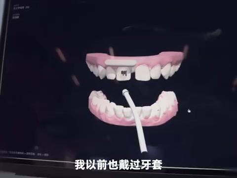 Dental simulator app interface