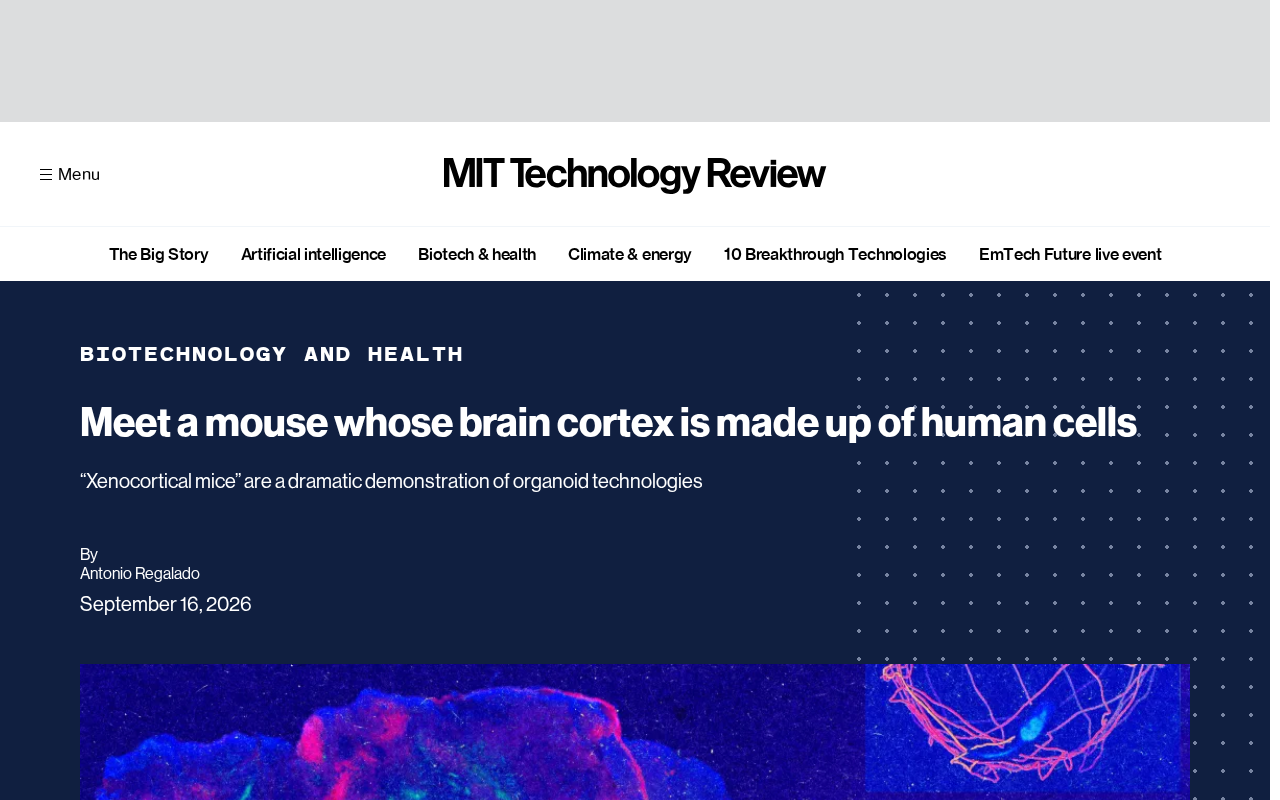 半个大脑由人类细胞构成:嵌合体小鼠背后的科学实验