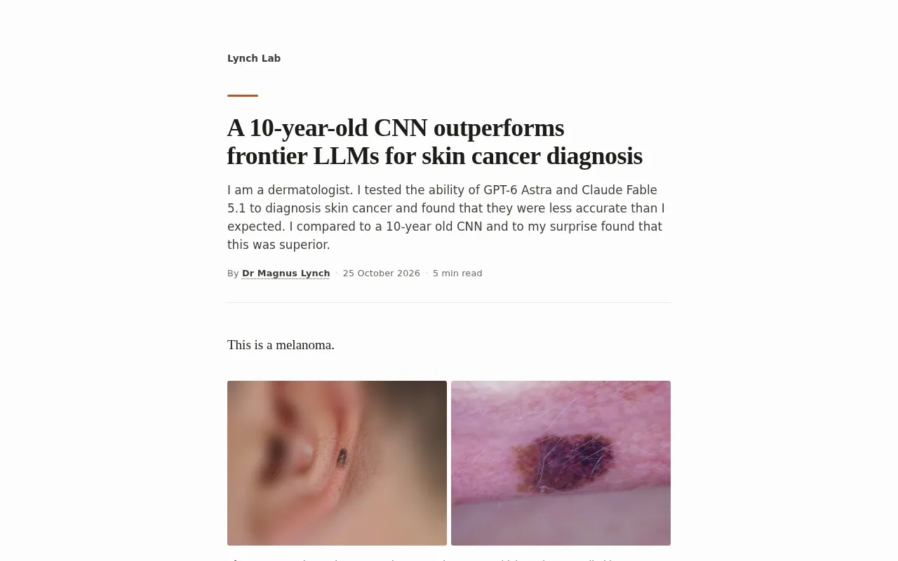 10年前的老CNN,竟比前沿大模型更会看皮肤癌