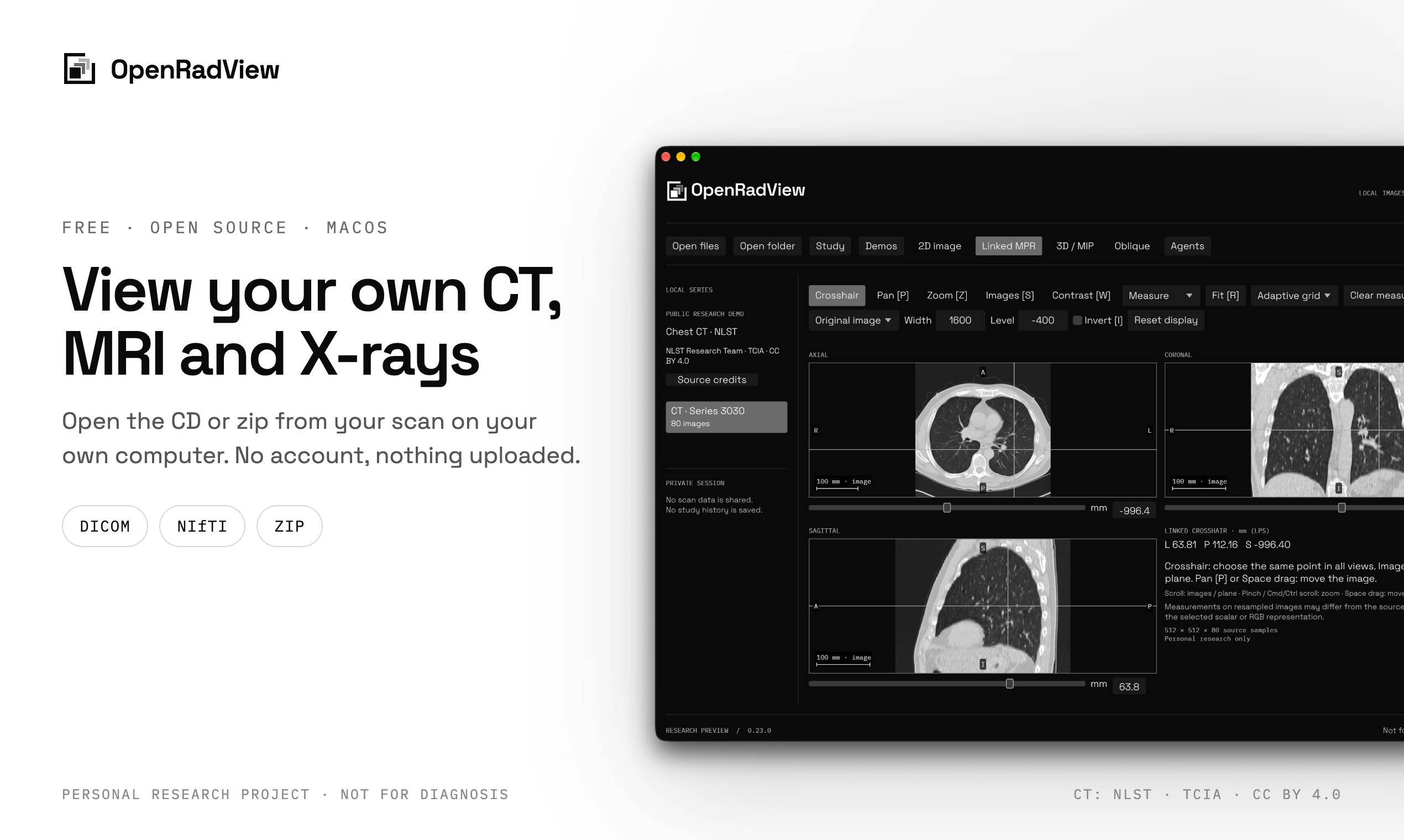 OpenRadView: A Free, Open-Source Medical Imaging Viewer with CT/MRI Support